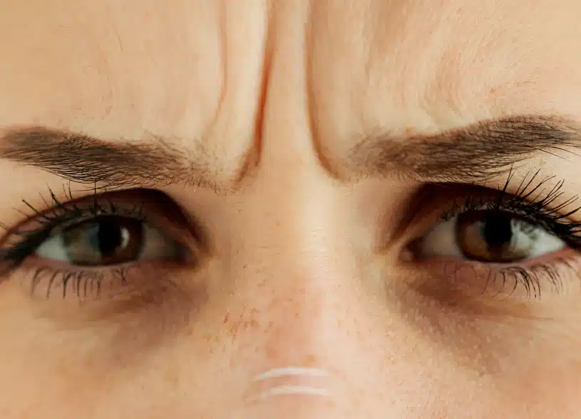 Vyhlaďte mimické vrásky bez botulotoxínu. Prípravok pôsobí na vašu pokožku počas spánku.